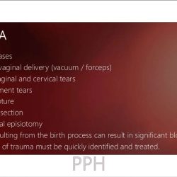 Ati real life postpartum hemorrhage