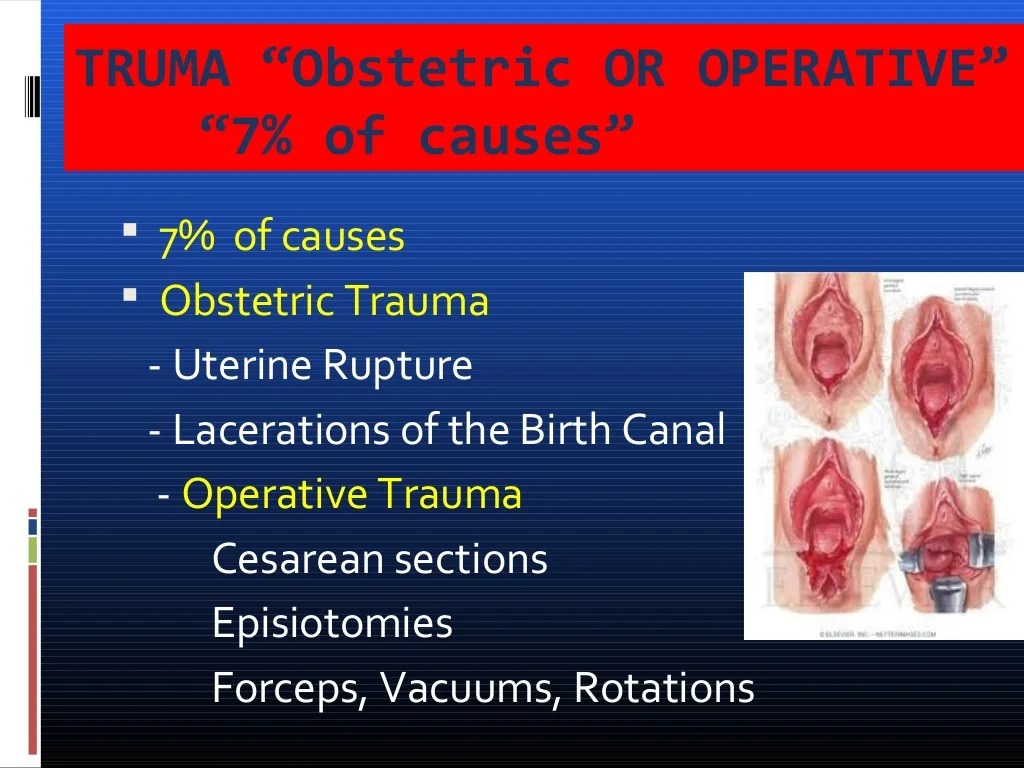 Ati real life postpartum hemorrhage